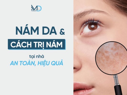 NÁM DA VÀ CÁCH ĐIỀU TRỊ NÁM