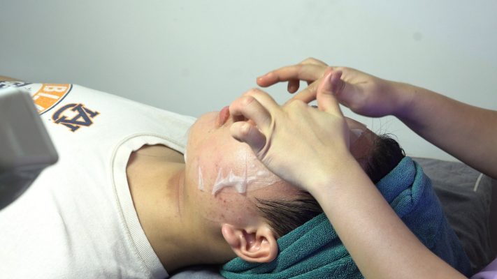 Quy trình điều trị mụn chuẩn Y Khoa tại Phòng khám của Bác sĩ Oanh