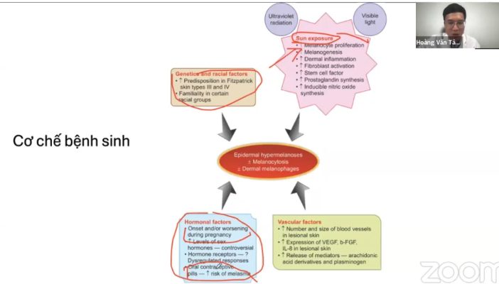 Bác sĩ Tâm chia sẻ về cơ chế bệnh sinh của nám da