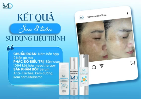 Hinh anh mo ta qua trinh tang sac to sau viem (PIH) hay con goi la tham mun