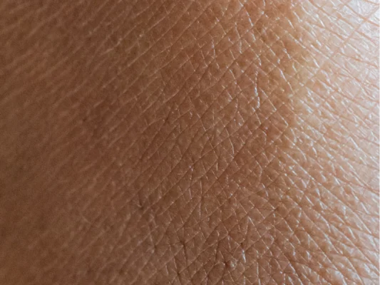 Bi quyet cham soc da kho mua dong hieu qua tu chuuyen gia